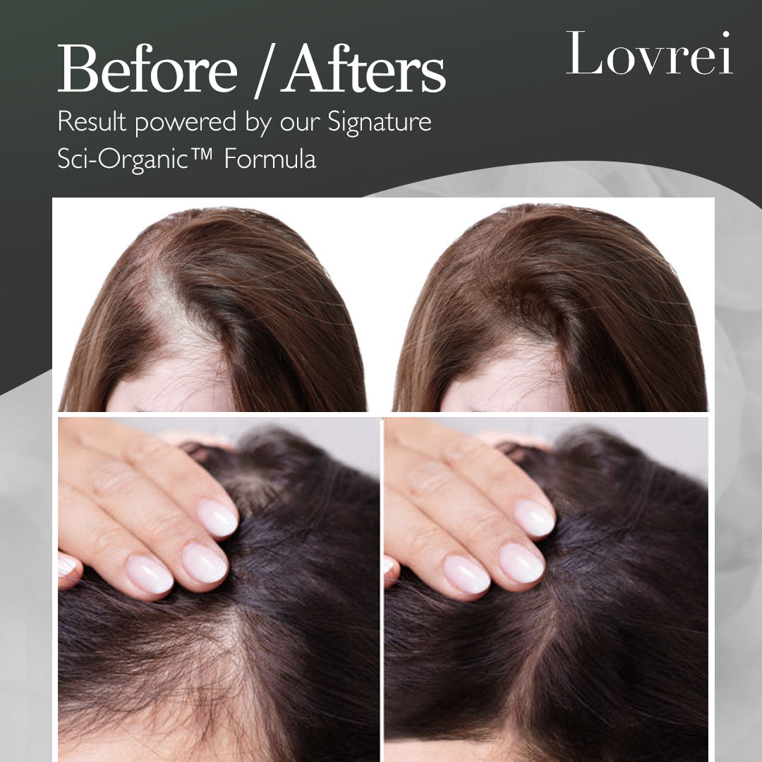 Total Hair-Care™ Solution (Ionic Hair Dryer + Shampoo & Serum)
